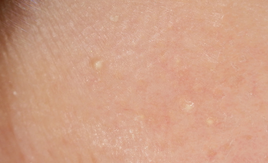 しゅ ひ 原因 りゅう